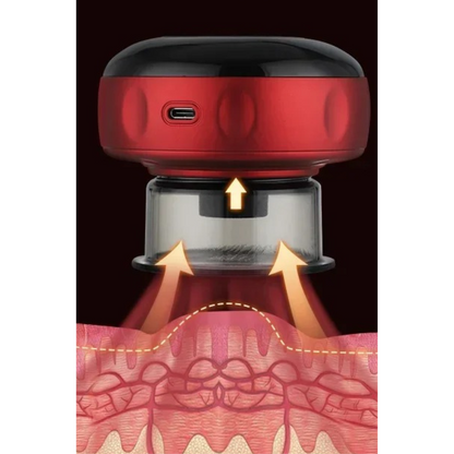 CUPRELIEF – Smart Vacuum Therapy