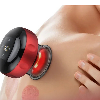 CUPRELIEF – Smart Vacuum Therapy