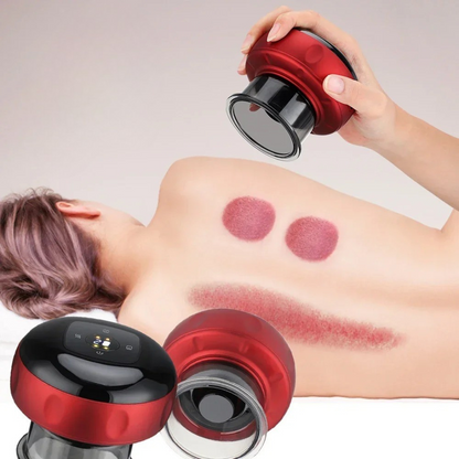 CUPRELIEF – Smart Vacuum Therapy